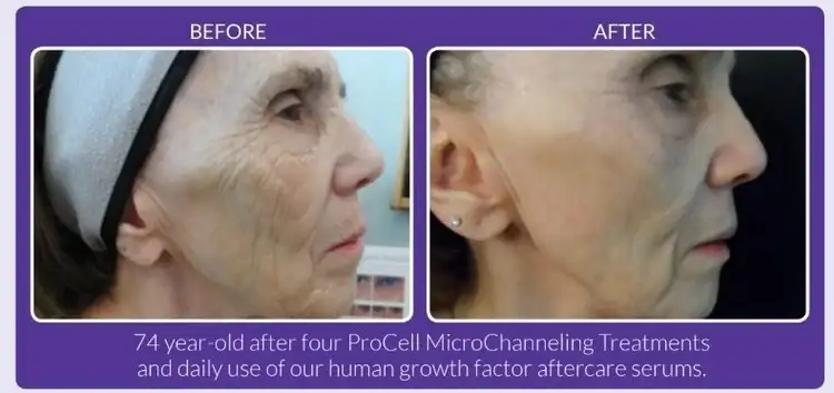 Before and after image.